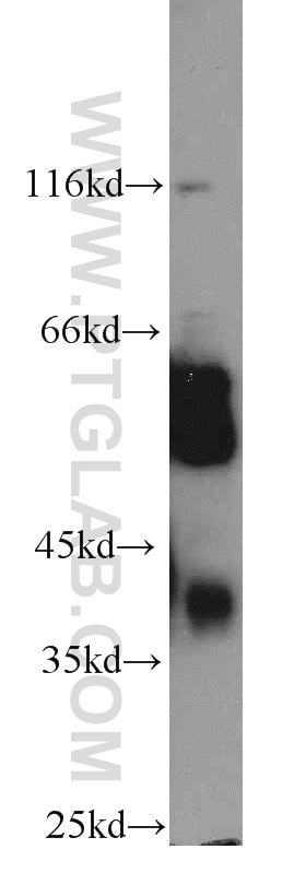 Western Blot (WB) analysis of HeLa cells using MICA Polyclonal antibody (12619-1-AP)