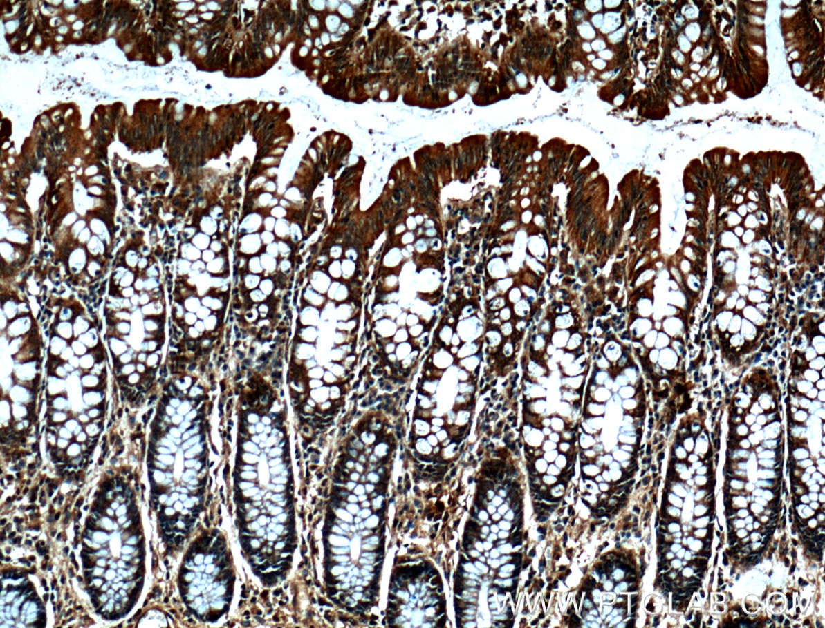 Immunohistochemistry (IHC) staining of human colon tissue using MICA Monoclonal antibody (66384-1-Ig)