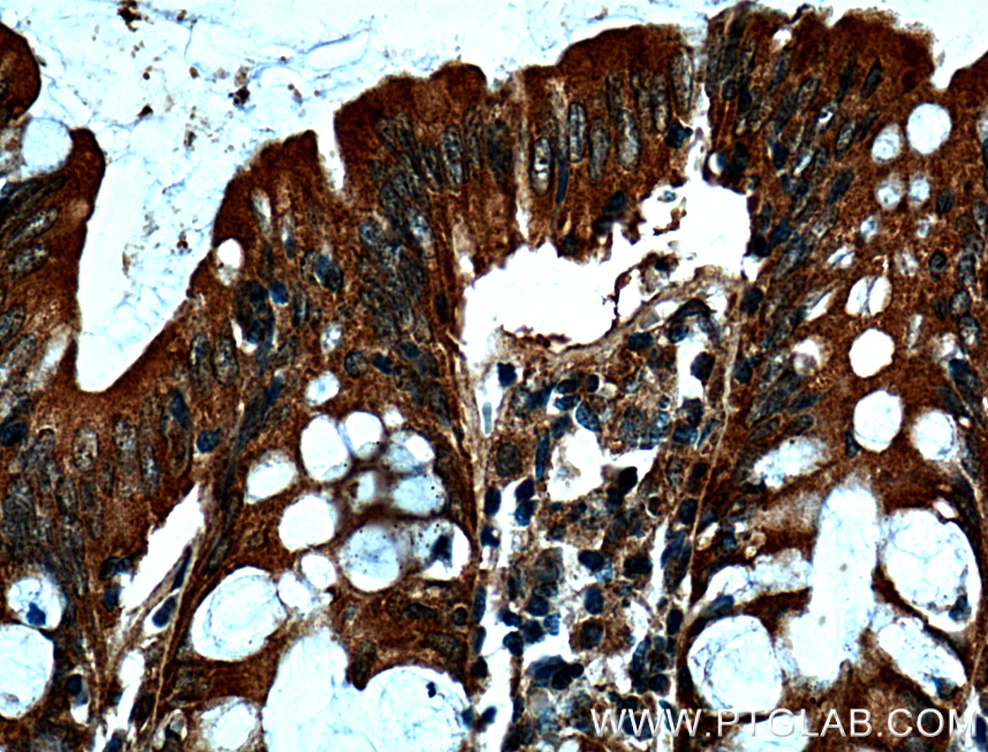 Immunohistochemistry (IHC) staining of human colon tissue using MICA Monoclonal antibody (66384-1-Ig)