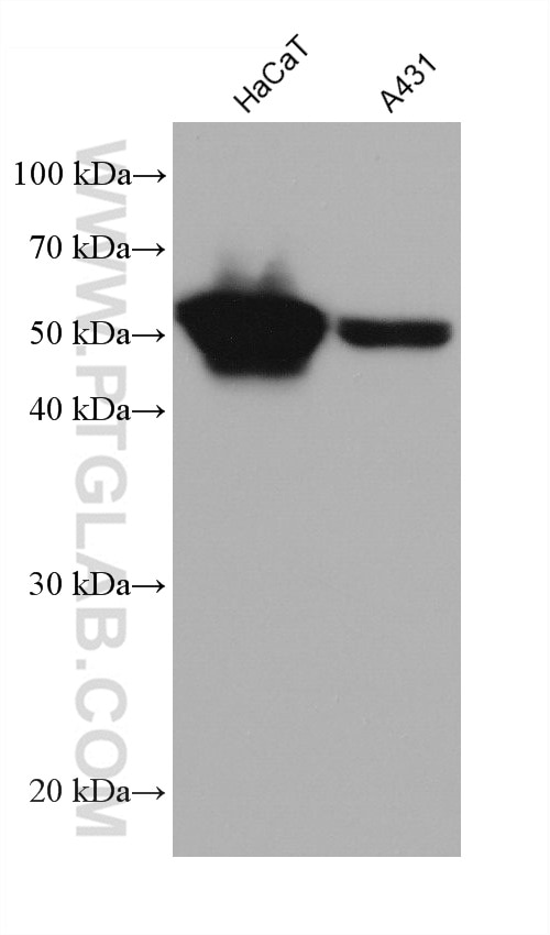 Western Blot (WB) analysis of various lysates using MICA Monoclonal antibody (66384-1-Ig)