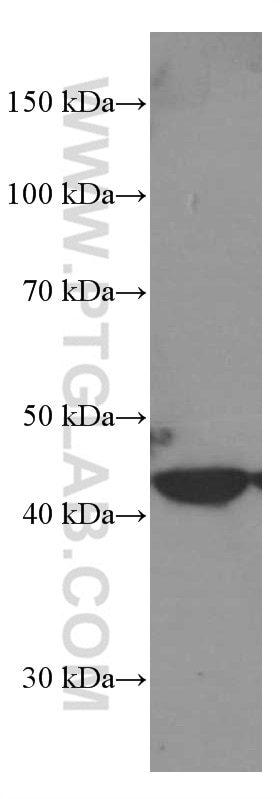 Western Blot (WB) analysis of Raji cells using MICA Monoclonal antibody (66384-1-Ig)
