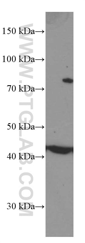 Western Blot (WB) analysis of Jurkat cells using MICA Monoclonal antibody (66384-1-Ig)