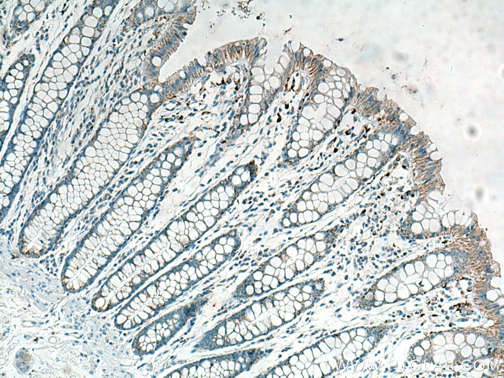 Immunohistochemistry (IHC) staining of human colon tissue using Biotin Anti-Human MICA/MICB (6D4) (Biotin-65161)