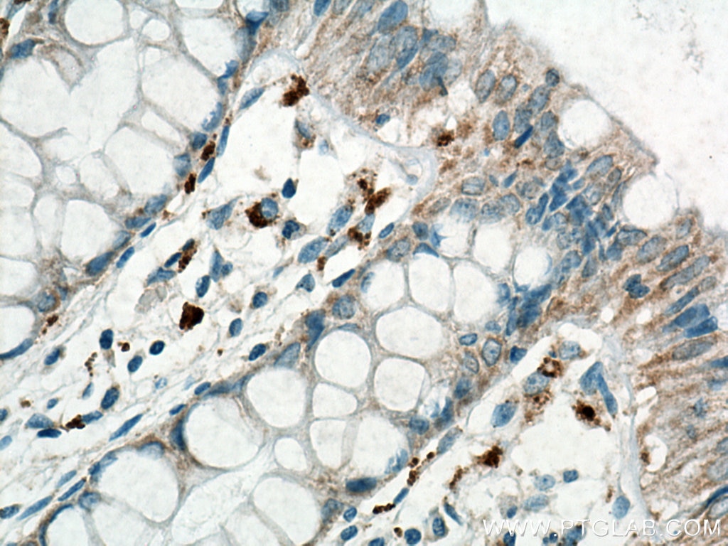 Immunohistochemistry (IHC) staining of human colon tissue using Biotin Anti-Human MICA/MICB (6D4) (Biotin-65161)