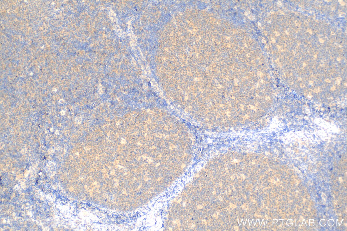 Immunohistochemistry (IHC) staining of human tonsillitis tissue using Biotin Anti-Human MICA/MICB (6D4) (Biotin-65161)