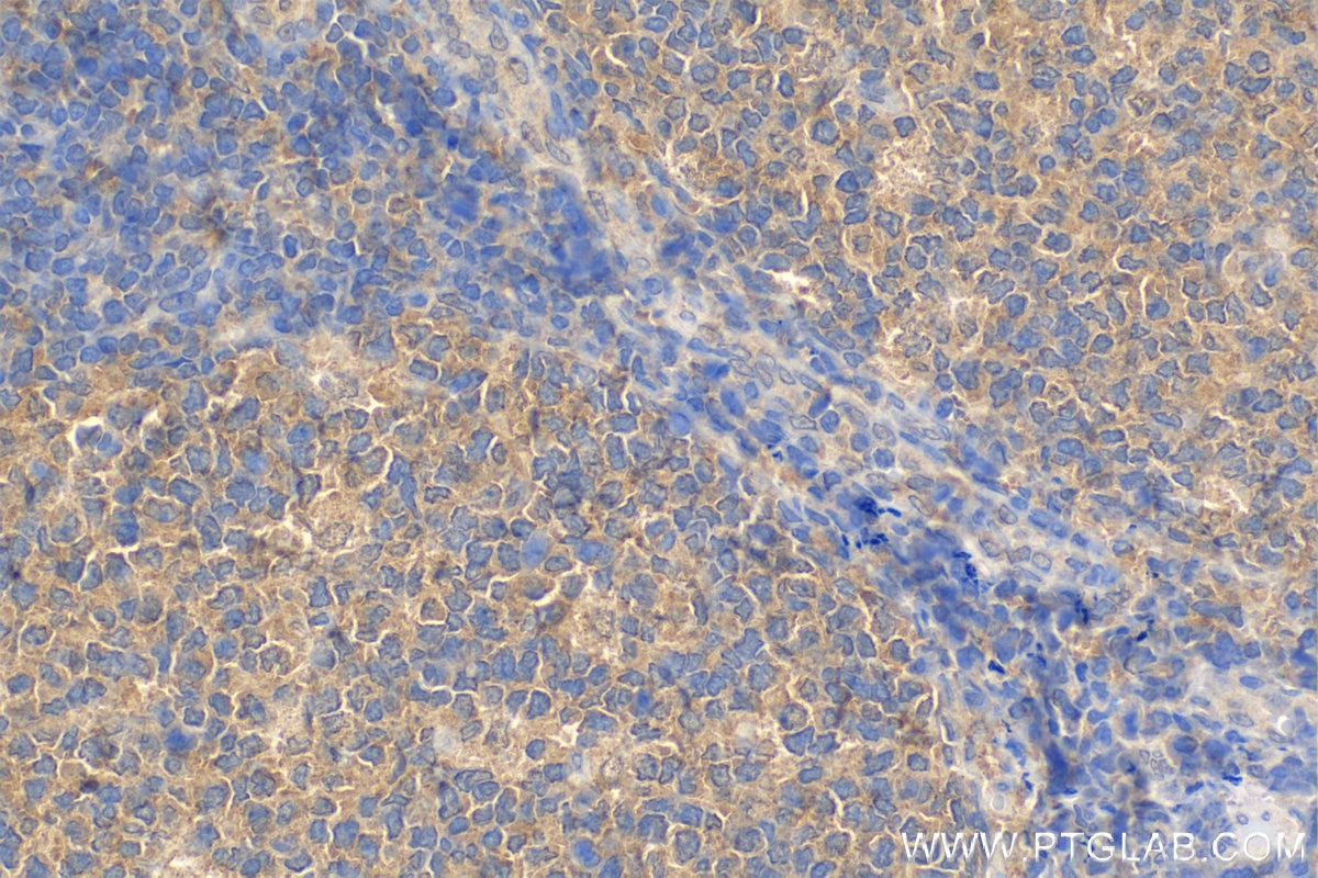 Immunohistochemistry (IHC) staining of human tonsillitis tissue using Biotin Anti-Human MICA/MICB (6D4) (Biotin-65161)