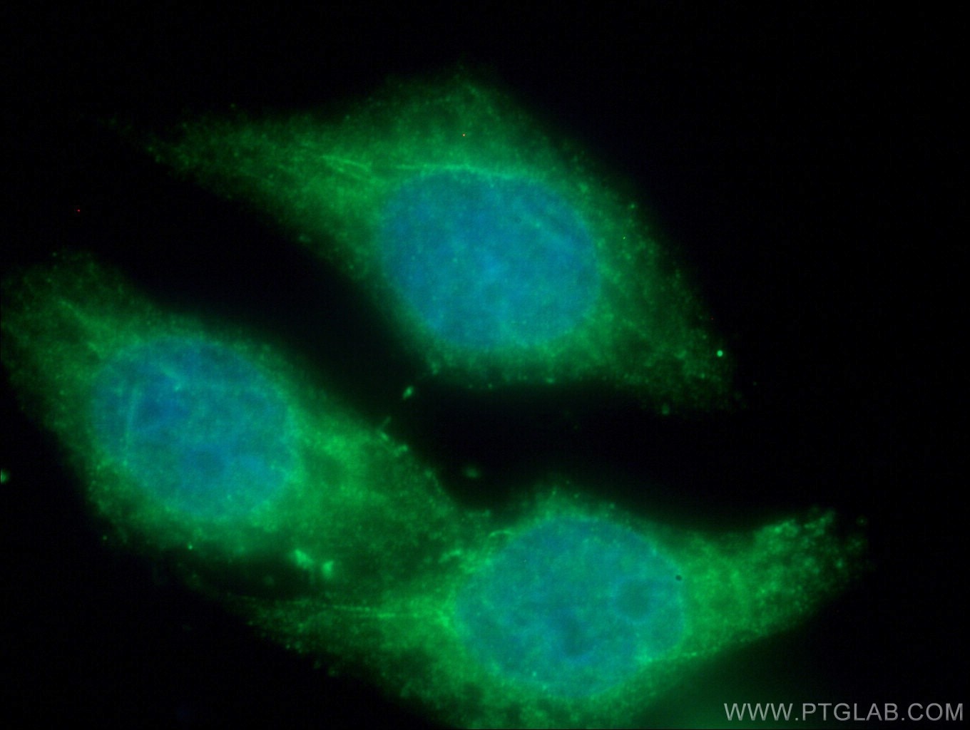 Immunofluorescence (IF) / fluorescent staining of HeLa cells using MICAL1 Polyclonal antibody (14818-1-AP)
