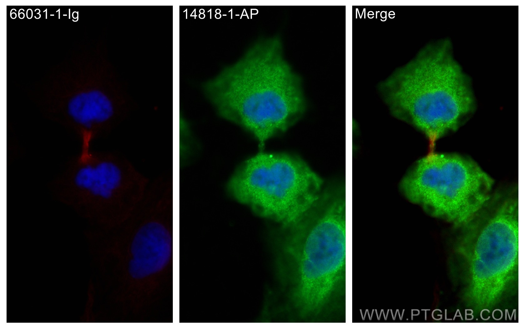 Immunofluorescence (IF) / fluorescent staining of A549 cells using MICAL1 Polyclonal antibody (14818-1-AP)