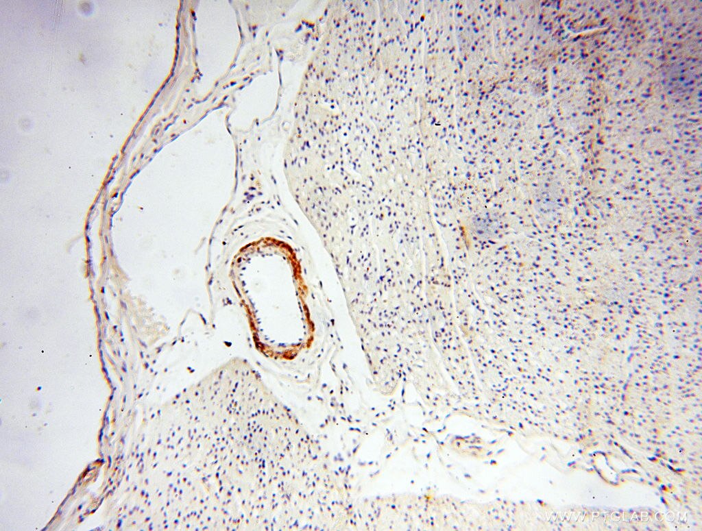 Immunohistochemistry (IHC) staining of human heart tissue using MICAL1 Polyclonal antibody (14818-1-AP)