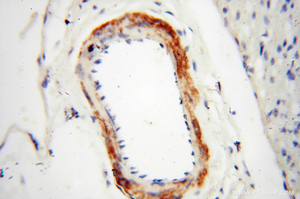 Immunohistochemistry (IHC) staining of human heart tissue using MICAL1 Polyclonal antibody (14818-1-AP)