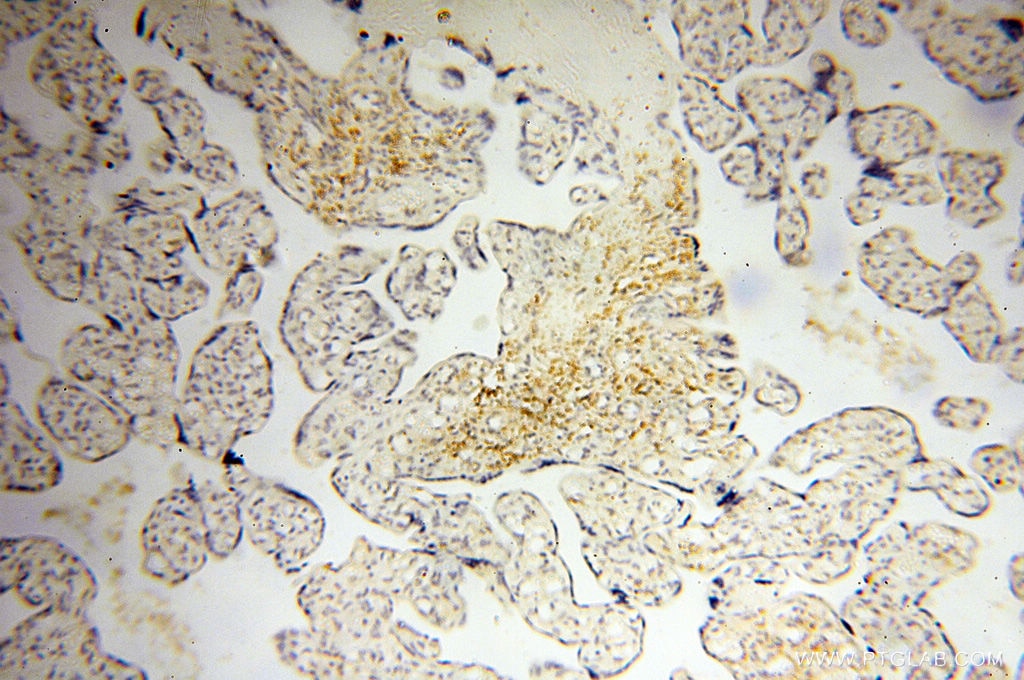 Immunohistochemistry (IHC) staining of human placenta tissue using MICAL1 Polyclonal antibody (14818-1-AP)