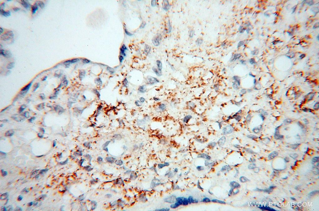 Immunohistochemistry (IHC) staining of human placenta tissue using MICAL1 Polyclonal antibody (14818-1-AP)
