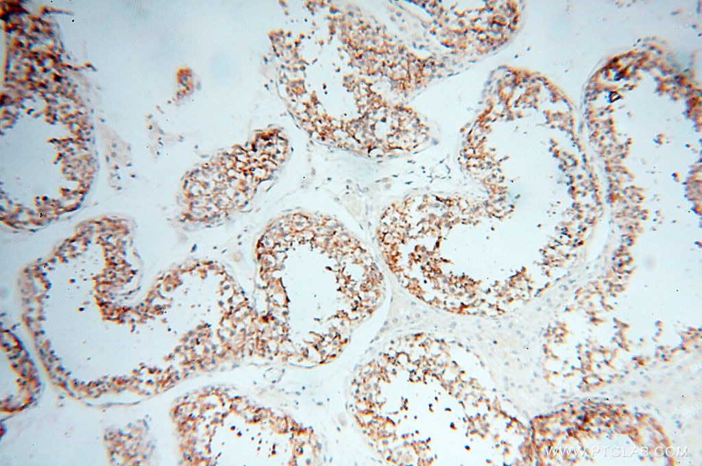 Immunohistochemistry (IHC) staining of human testis tissue using MICAL1 Polyclonal antibody (14818-1-AP)