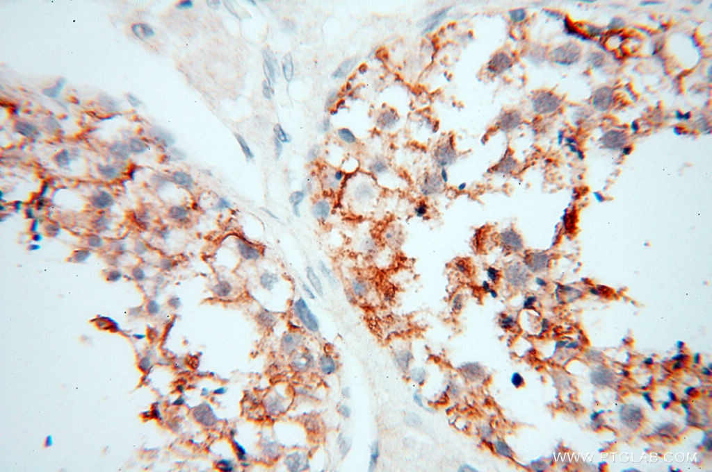 Immunohistochemistry (IHC) staining of human testis tissue using MICAL1 Polyclonal antibody (14818-1-AP)