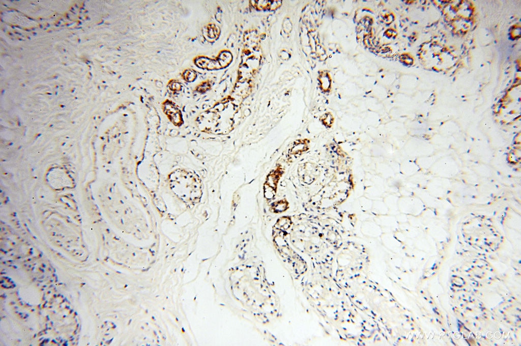 Immunohistochemistry (IHC) staining of human skin tissue using MICAL1 Polyclonal antibody (14818-1-AP)