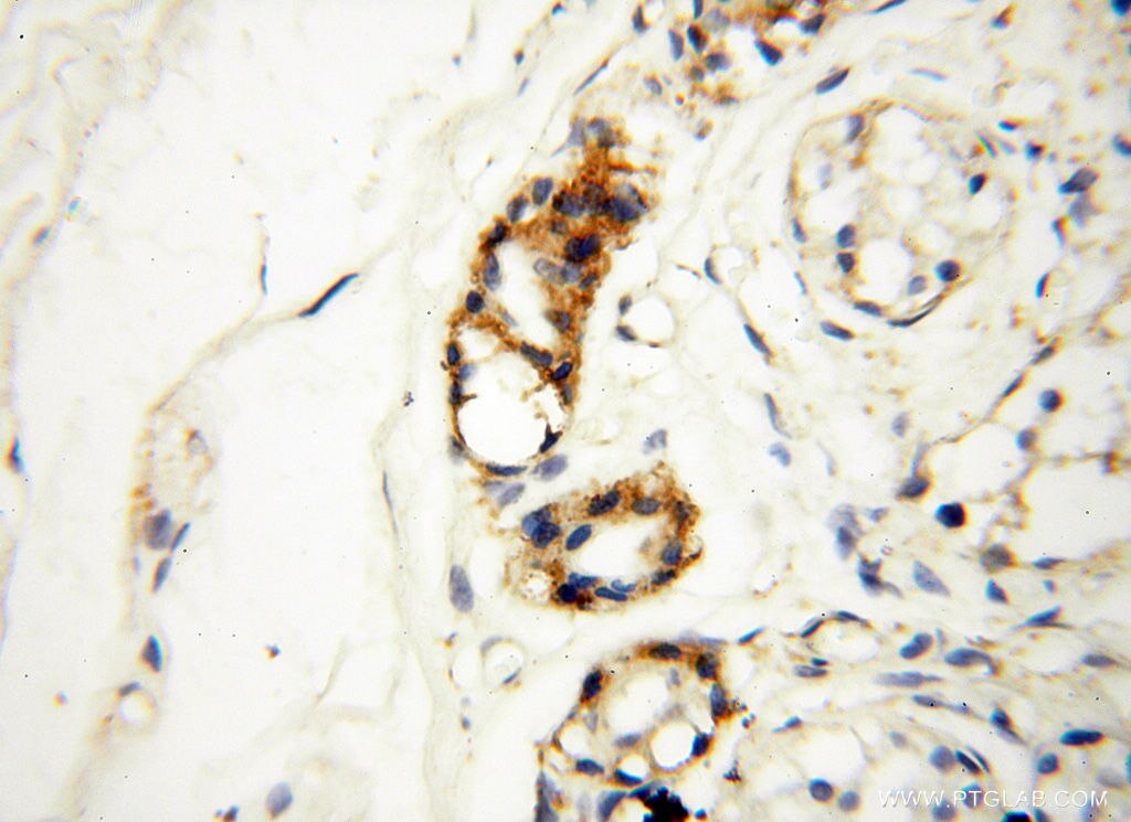 IHC staining of human skin using 14818-1-AP