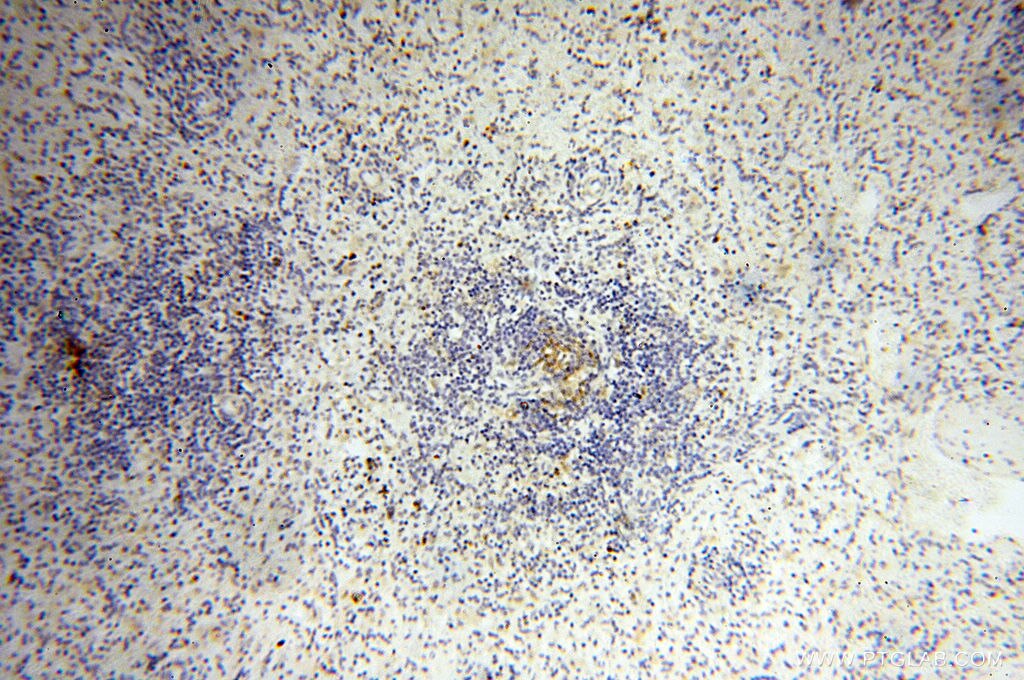 Immunohistochemistry (IHC) staining of human spleen tissue using MICAL1 Polyclonal antibody (14818-1-AP)