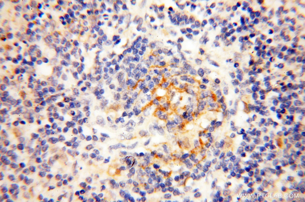 IHC staining of human spleen using 14818-1-AP