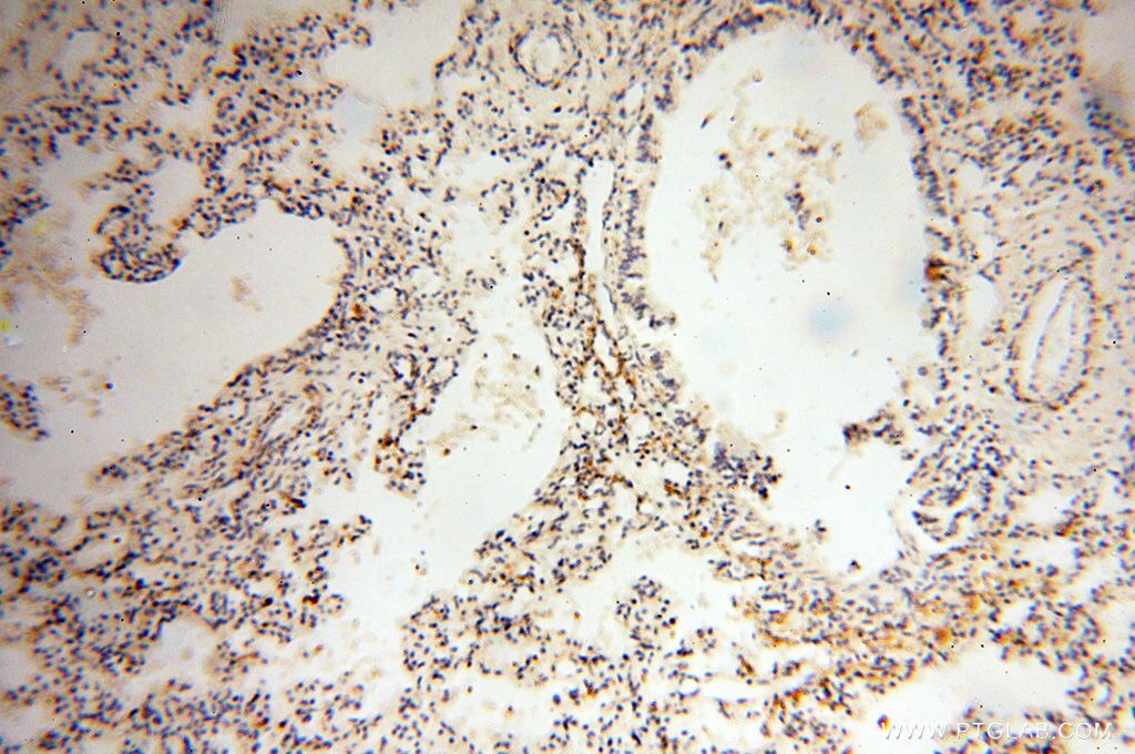 Immunohistochemistry (IHC) staining of human lung tissue using MICAL1 Polyclonal antibody (14818-1-AP)