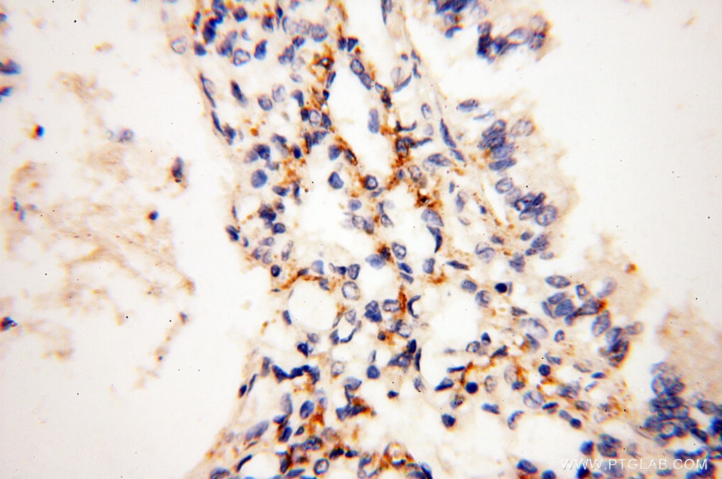 Immunohistochemistry (IHC) staining of human lung tissue using MICAL1 Polyclonal antibody (14818-1-AP)