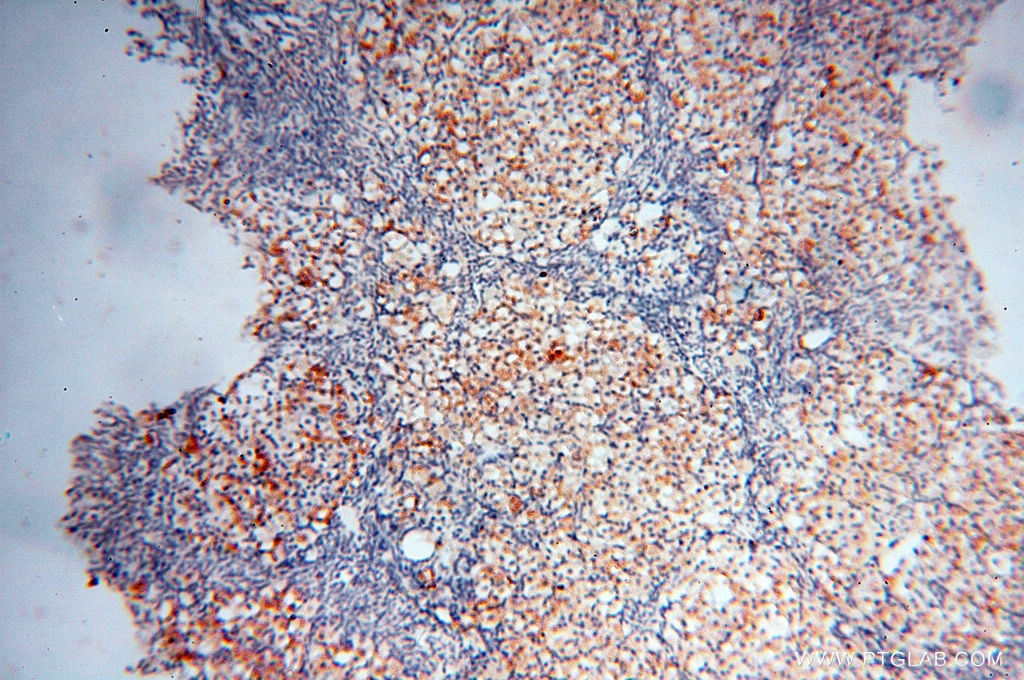 Immunohistochemistry (IHC) staining of human ovary tissue using MICAL1 Polyclonal antibody (14818-1-AP)