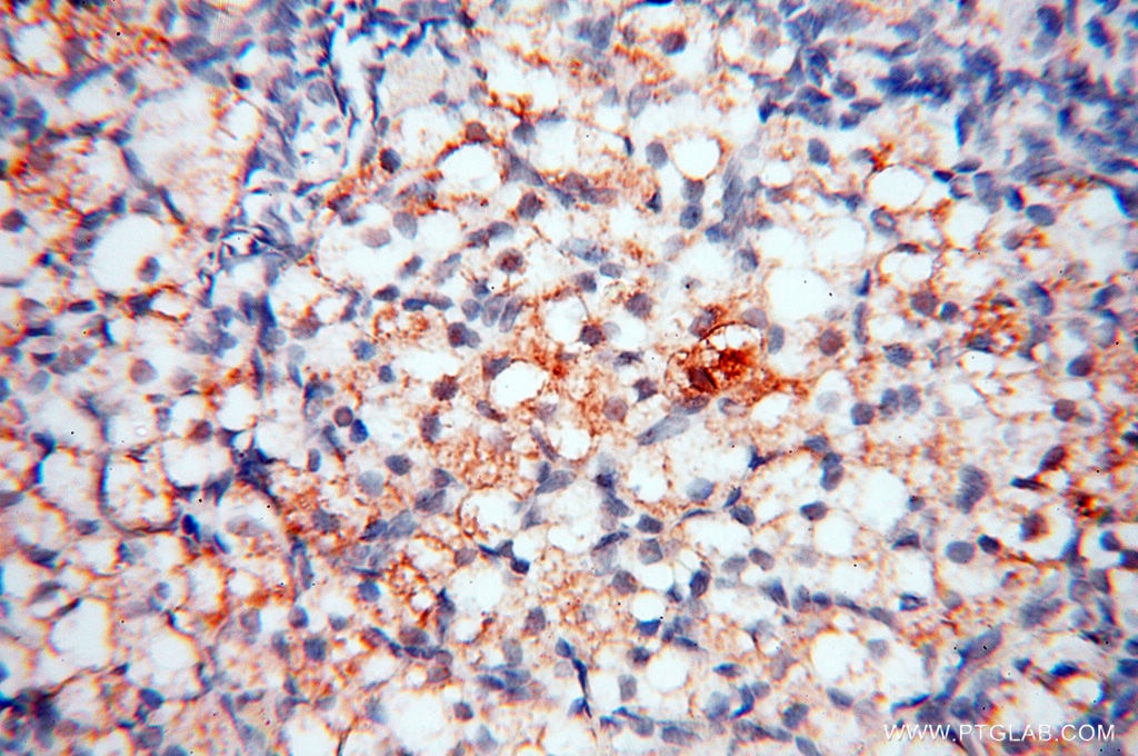 IHC staining of human ovary using 14818-1-AP