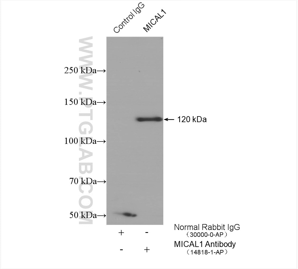 Immunoprecipitation (IP) experiment of T-47D cells using MICAL1 Polyclonal antibody (14818-1-AP)