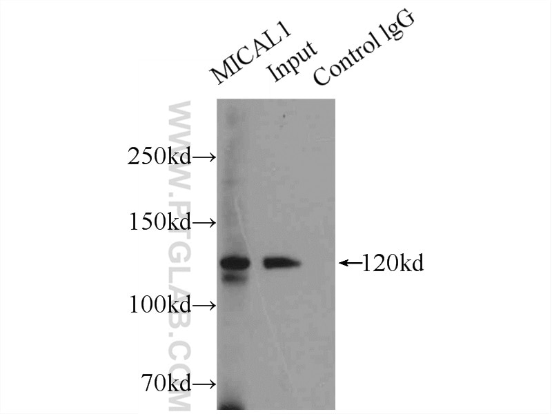 Immunoprecipitation (IP) experiment of HeLa cells using MICAL1 Polyclonal antibody (14818-1-AP)