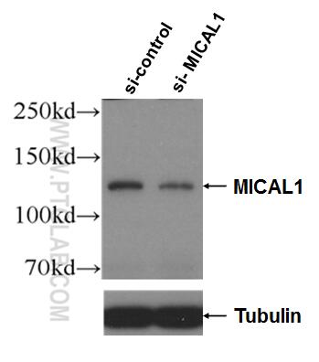 WB analysis of HeLa using 14818-1-AP