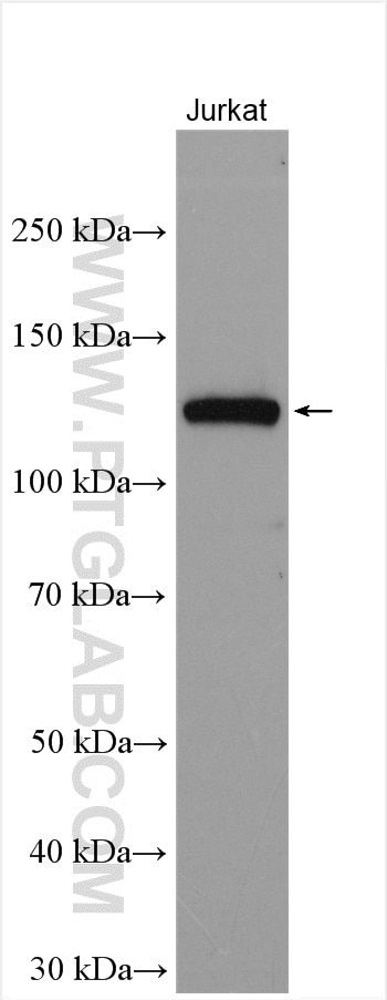 WB analysis of Jurkat using 14818-1-AP