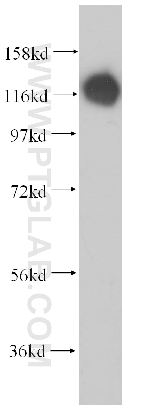 Western Blot (WB) analysis of human brain tissue using MICAL1 Polyclonal antibody (14818-1-AP)