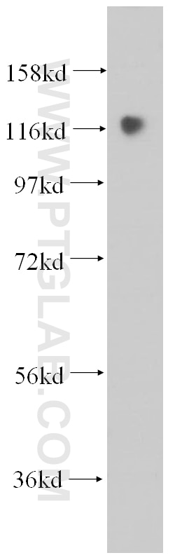 Western Blot (WB) analysis of mouse lung tissue using MICAL1 Polyclonal antibody (14818-1-AP)