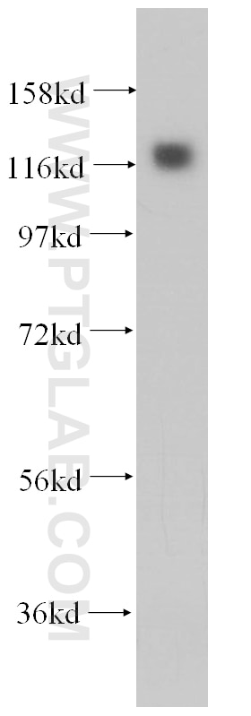 Western Blot (WB) analysis of Jurkat cells using MICAL1 Polyclonal antibody (14818-1-AP)