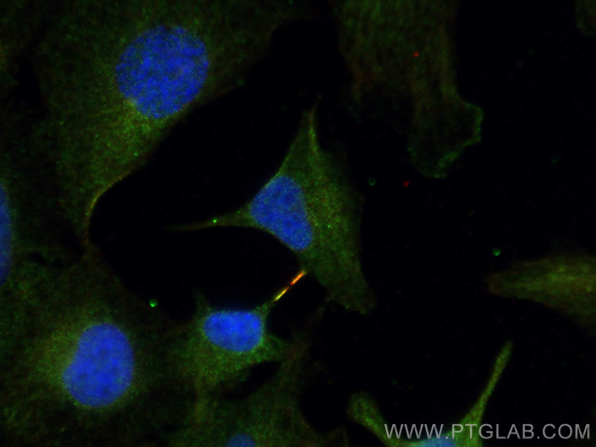 Immunofluorescence (IF) / fluorescent staining of A549 cells using MICAL1 Monoclonal antibody (68297-1-Ig)