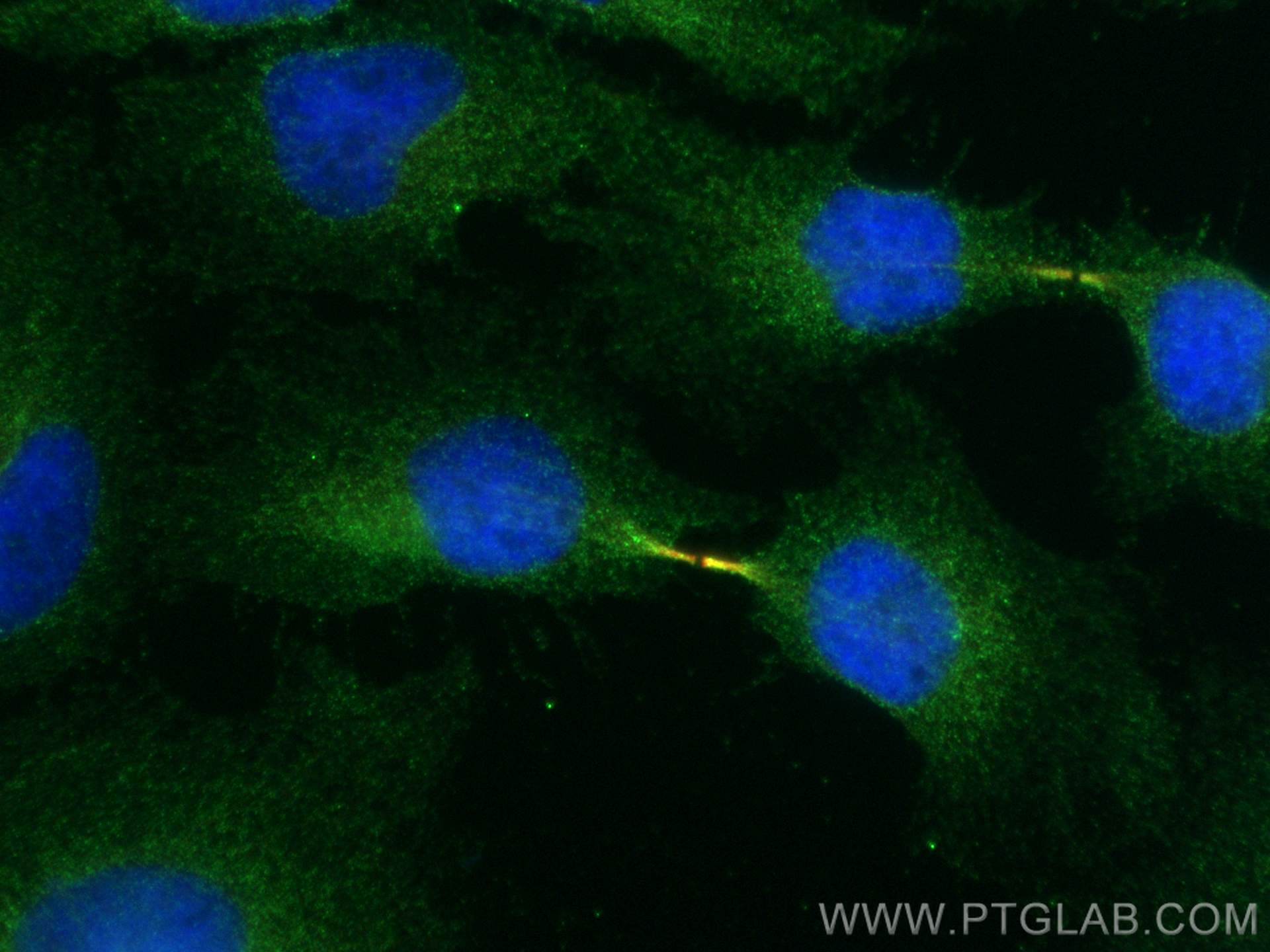 Immunofluorescence (IF) / fluorescent staining of HeLa cells using MICAL1 Monoclonal antibody (68297-1-Ig)