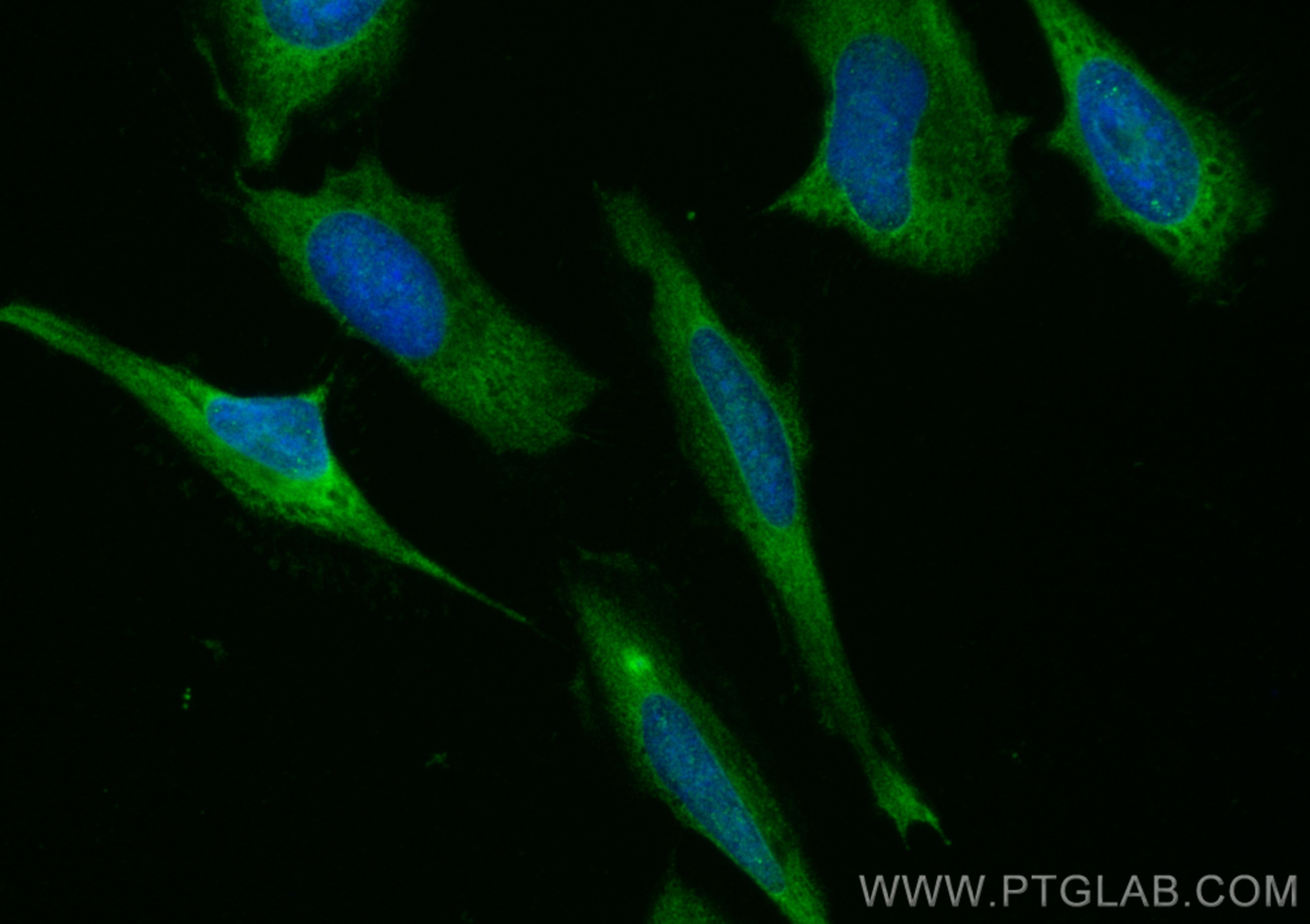 Immunofluorescence (IF) / fluorescent staining of HeLa cells using CoraLite® Plus 488-conjugated MICAL1 Polyclonal an (CL488-14818)