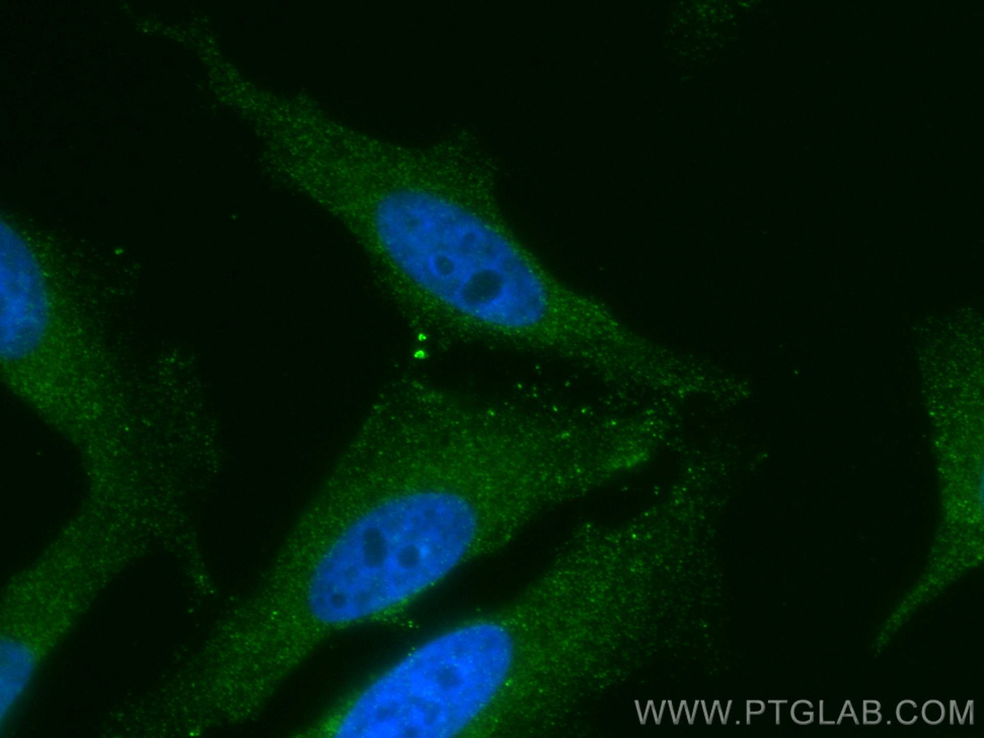 Immunofluorescence (IF) / fluorescent staining of HeLa cells using CoraLite® Plus 488-conjugated MICAL1 Monoclonal an (CL488-68297)