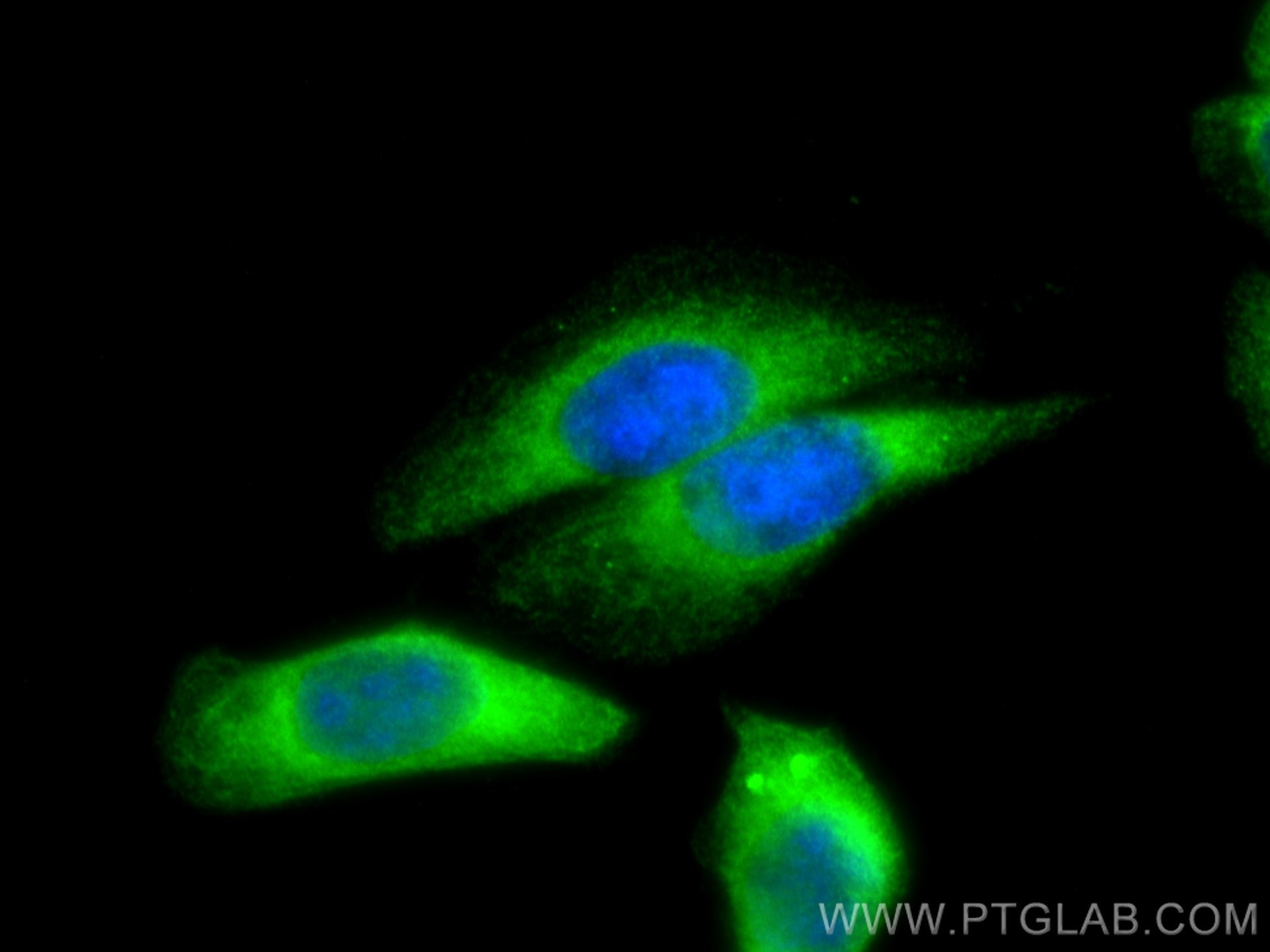 Immunofluorescence (IF) / fluorescent staining of HepG2 cells using MICAL2 Polyclonal antibody (13965-1-AP)