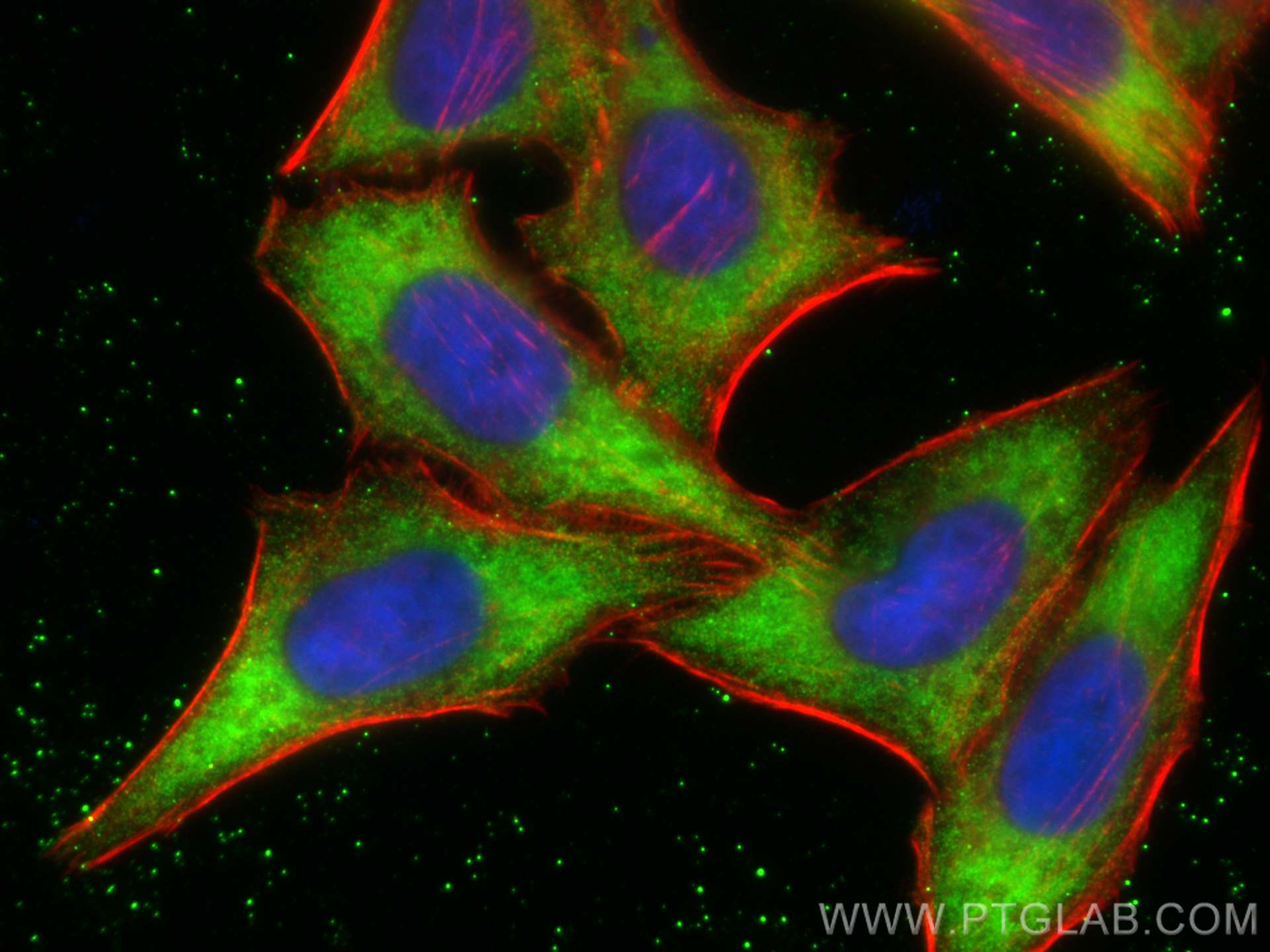 Immunofluorescence (IF) / fluorescent staining of HepG2 cells using MICAL2 Polyclonal antibody (13965-1-AP)