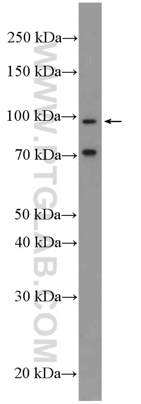 Western Blot (WB) analysis of PC-3 cells using MICAL2 Polyclonal antibody (13965-1-AP)