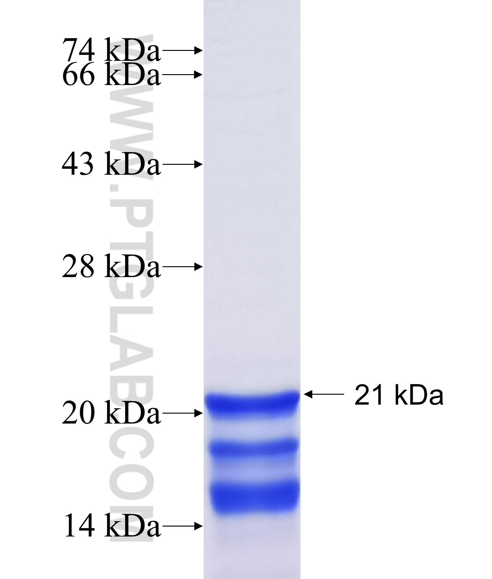 MICAL3 fusion protein Ag20962 SDS-PAGE