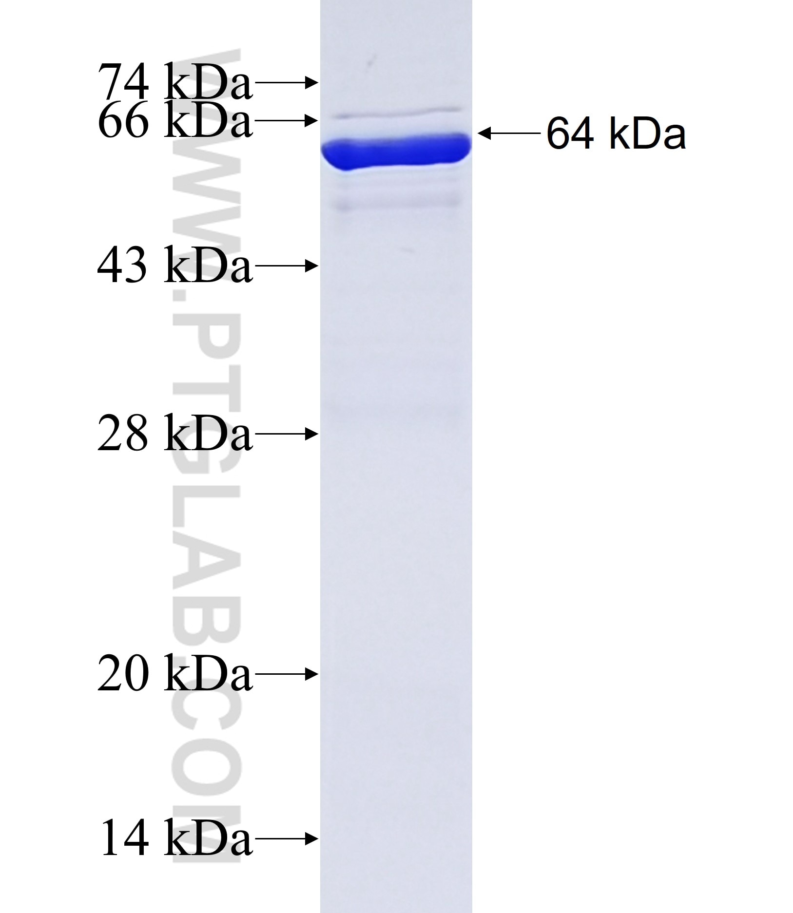 MID1 fusion protein Ag38146 SDS-PAGE