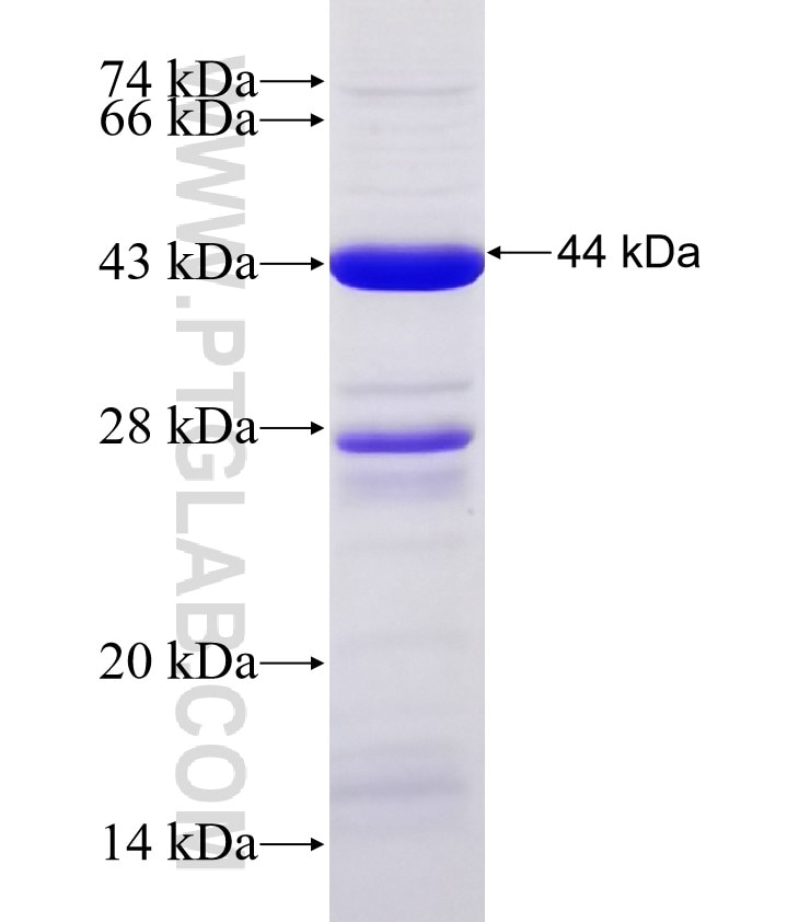MID2 fusion protein Ag30793 SDS-PAGE