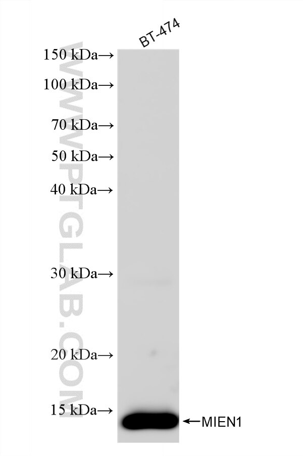 WB analysis of BT-474 using 87911-1-RR (same clone as 87911-1-PBS) Western Blot (WB) analysis of BT-474 cells using MIEN1 Recombinant monoclonal antibody (87911-1-RR)