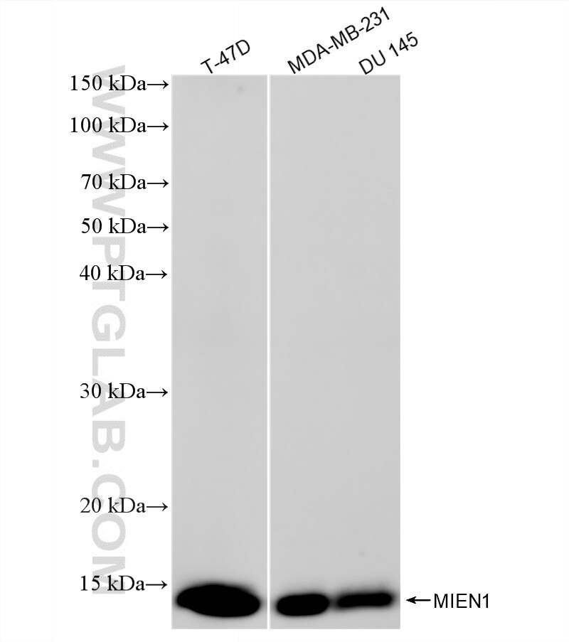 WB analysis using 87911-1-RR (same clone as 87911-1-PBS) Western Blot (WB) analysis of various lysates using MIEN1 Recombinant monoclonal antibody (87911-1-RR)