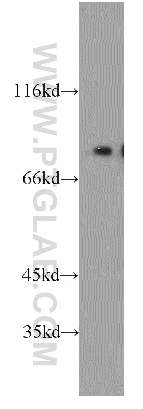Western Blot (WB) analysis of HepG2 cells using MIER1 Polyclonal antibody (11452-1-AP)