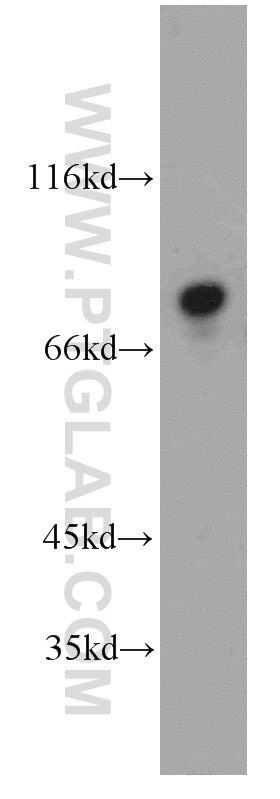 Western Blot (WB) analysis of HepG2 cells using MIER1 Polyclonal antibody (11452-1-AP)