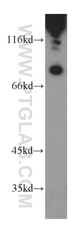 Western Blot (WB) analysis of mouse heart tissue using MIER1 Polyclonal antibody (11452-1-AP)