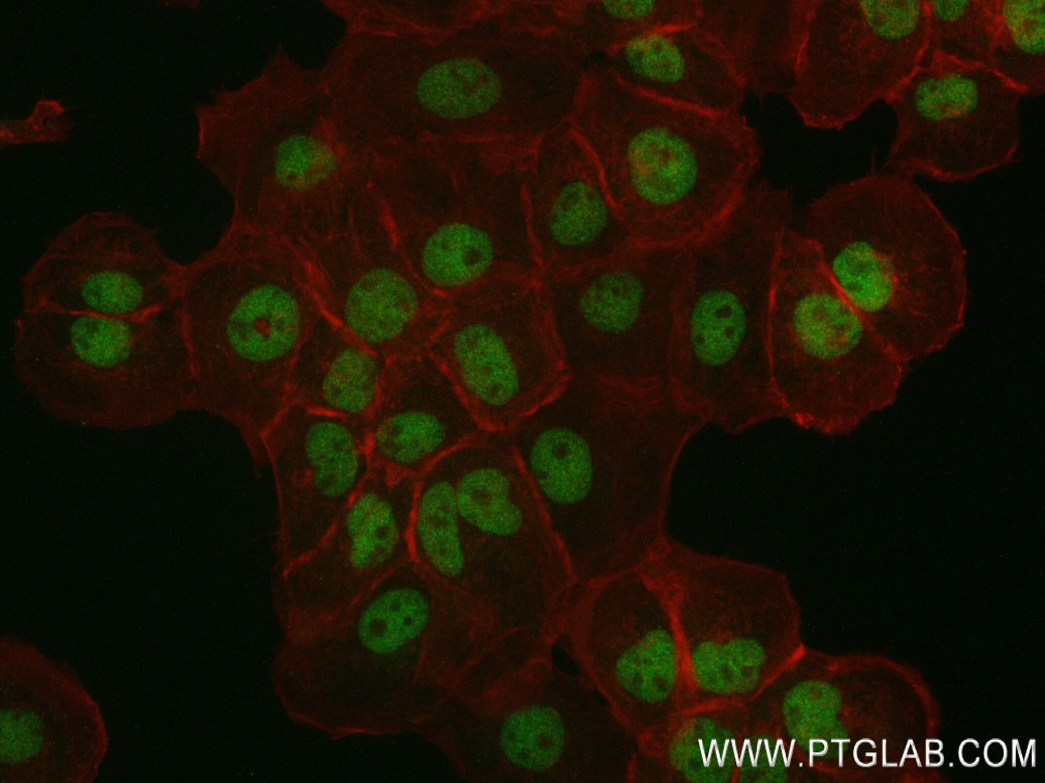 Immunofluorescence (IF) / fluorescent staining of A431 cells using MIER2 Recombinant antibody (84216-1-RR)