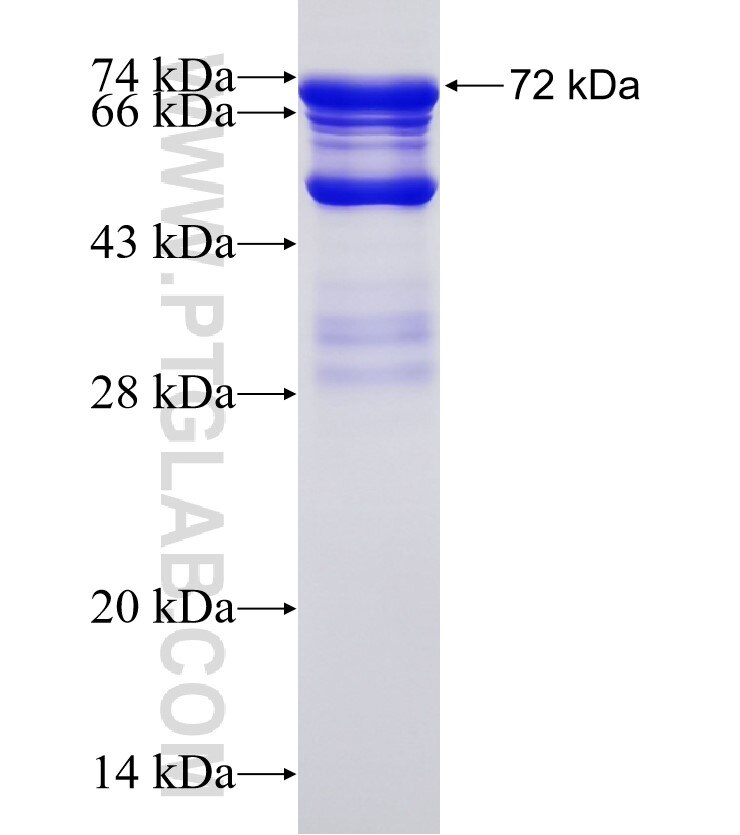 MIER2 fusion protein Ag11491 SDS-PAGE